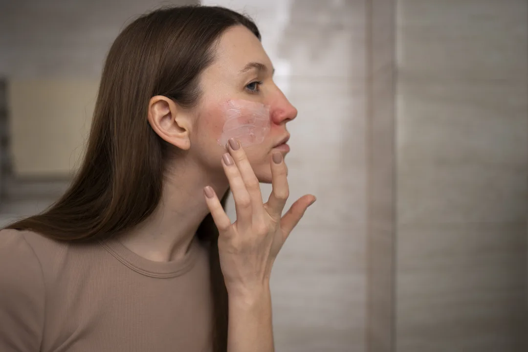 Dry Skin SOS