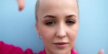 The Truth About Hair Loss: Causes, Prevention, and Effective Treatments - Cover Image